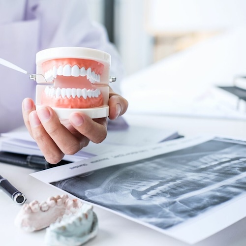 Denture Evaluation